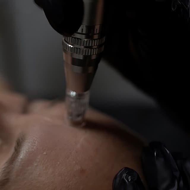 • 6 Session Micro Needling • at HeavnSkin | Luxury Skin Studio in Tampa, FL